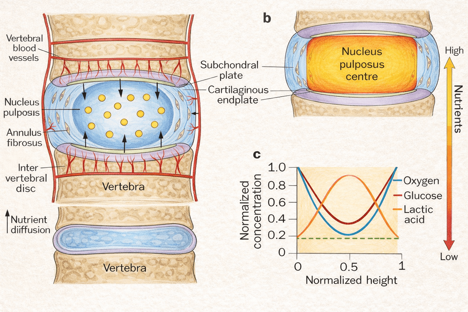 Course à pied et mal de dos
